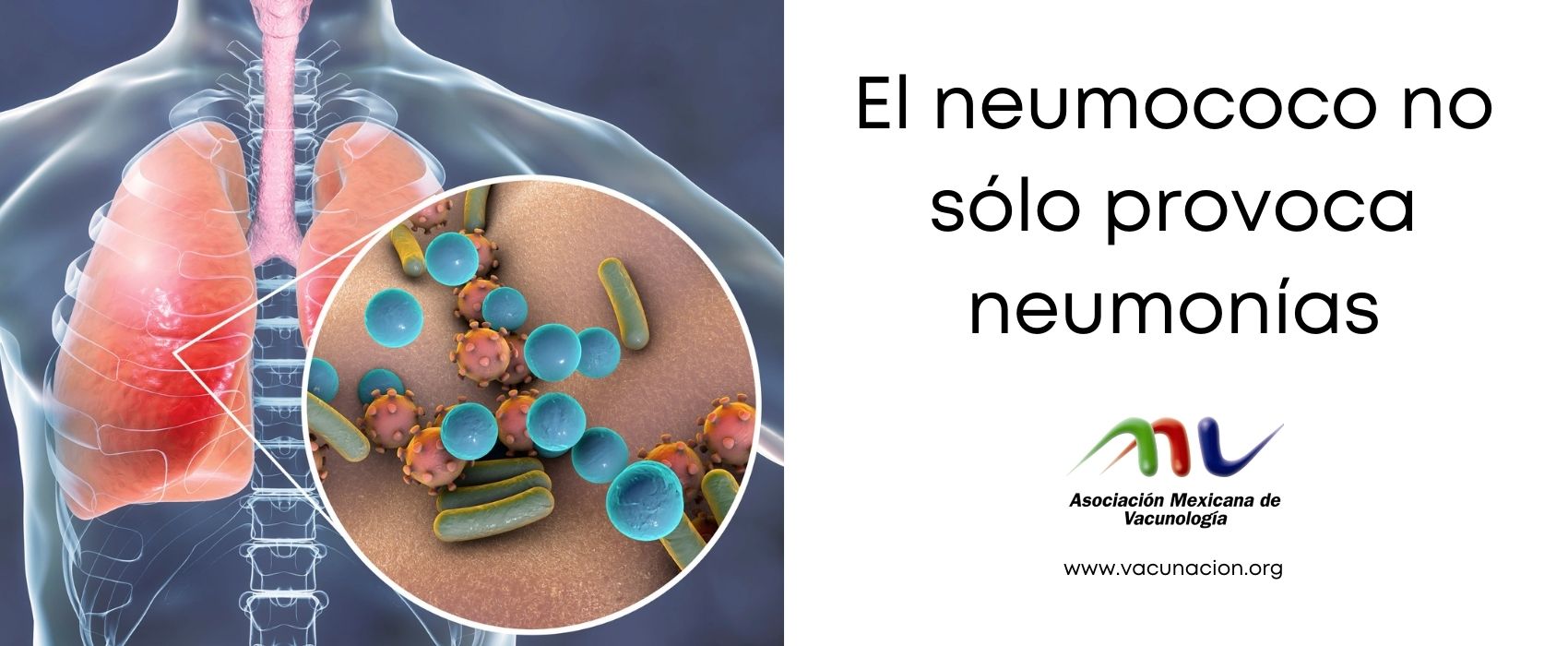Vacunación Noticias El neumococo no sólo provoca neumonías